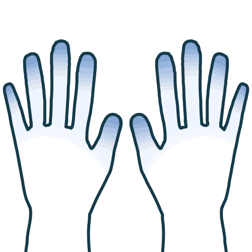 強皮症(全身性強皮症)